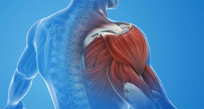 درمان خانگی کشیدگی تاندون شانه